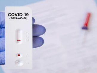 glovo test domicilio
