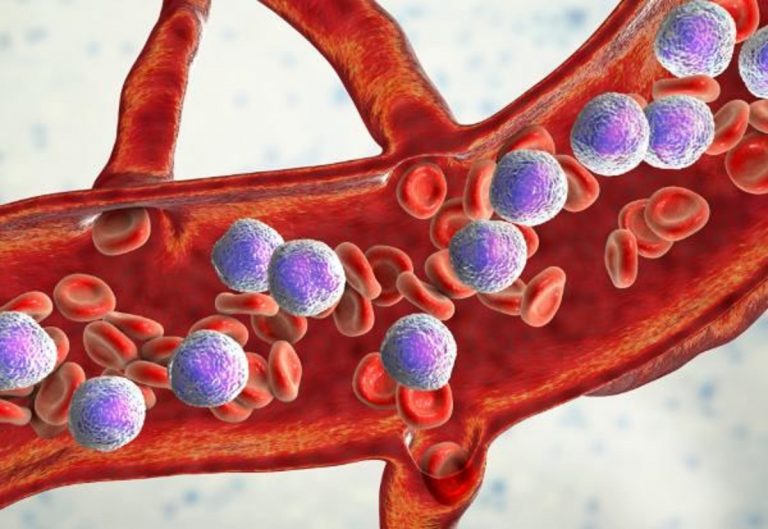 hijo enfermo de leucemia