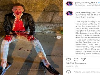 El taekwondista sufrió una brutal agresión en su Irlanda natal