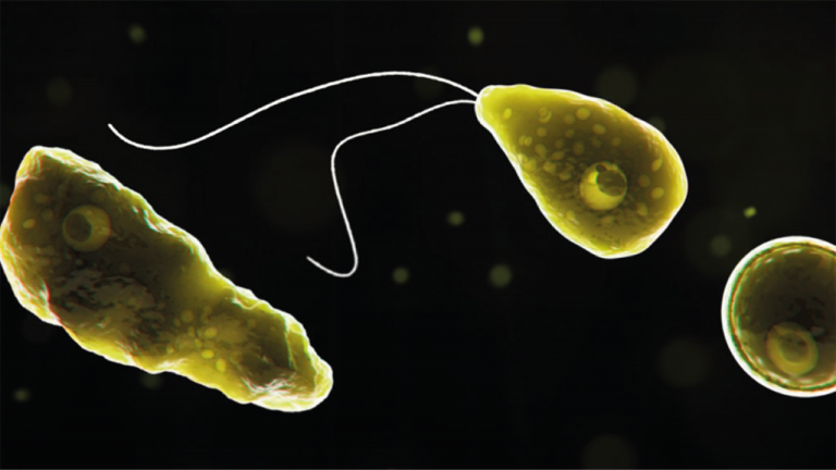 Ameba Come Cerebro Niño Muere
