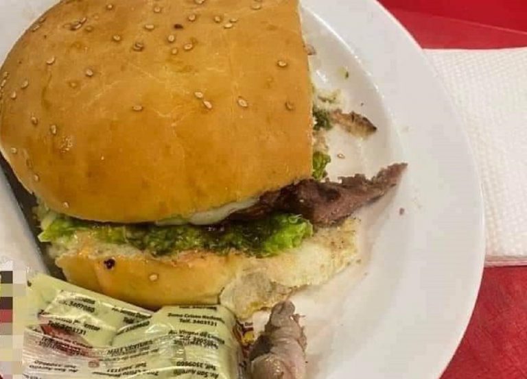 Dedo humano en la hamburguesa