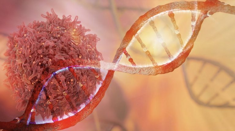 tratamiento tumores cerebrales
