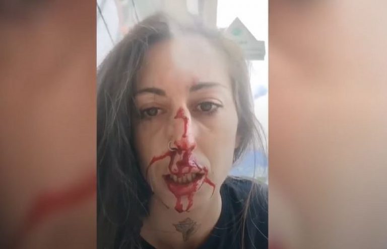 Agredida joven por defender un perro