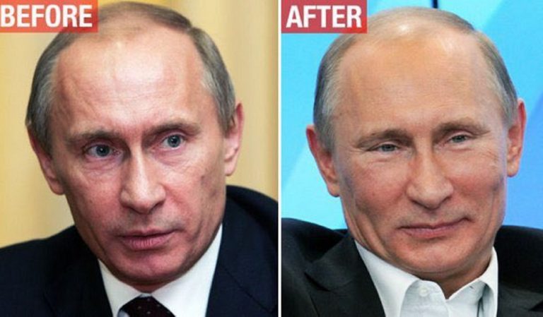 Putin enfermo