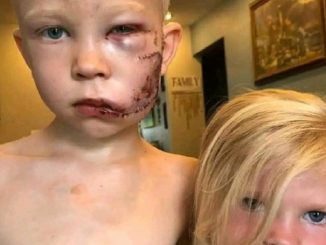 niño salvó hermana perro