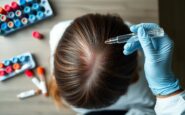 como identificar y tratar la caida del cabello vinculada a la ferritina 1773727846