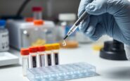 panel de cuatro biomarcadores mejora la deteccion temprana del cancer de pancreas 1773814258
