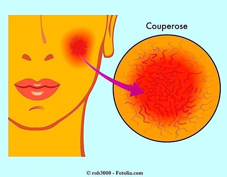 Fotolia 51506316 Subscription XXL