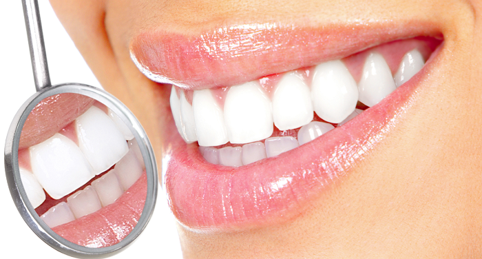denti bianchi