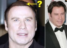 chirurgia estetica uomo vip 1