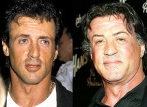 chirurgia estetica uomo vip 3