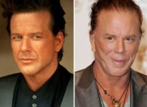 chirurgia estetica uomo vip 7