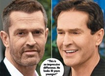 rupert everett lifting a confronto