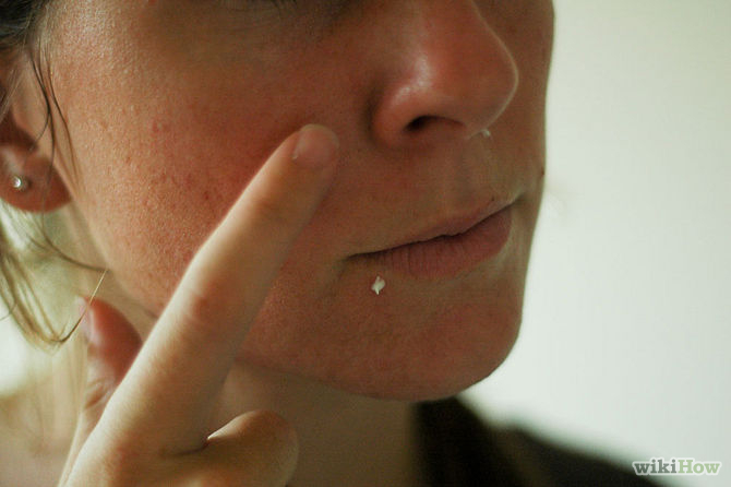 670px Reduce Pimple Redness With Mint Toothpaste Step 3