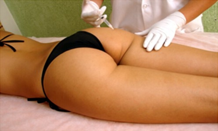 Che cos’ è la mesoterapia contro la cellulite?