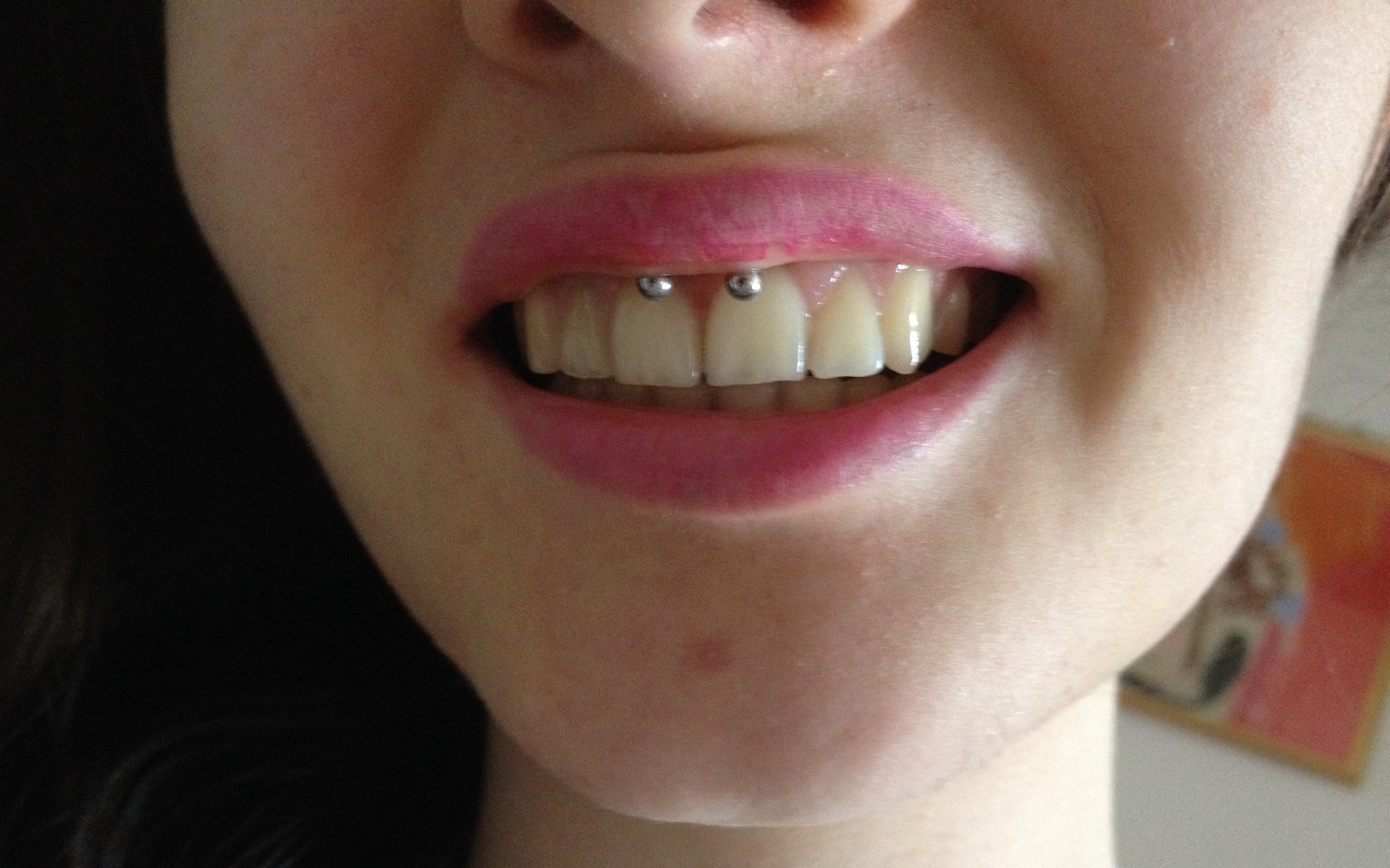 Come fare smiley piercing da sola