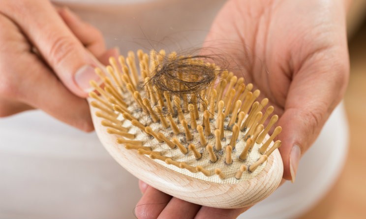 caduta capelli rimedi naturali 744x445