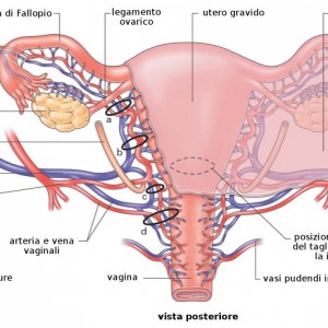 Quali sono sintomi tumore all'utero