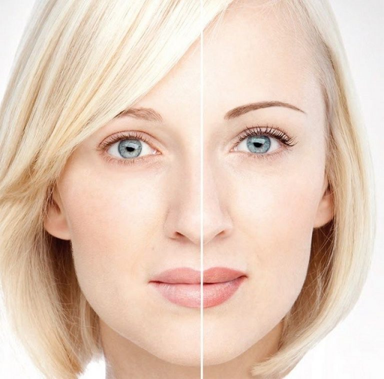 Come decolorare sopracciglia con acqua ossigenata