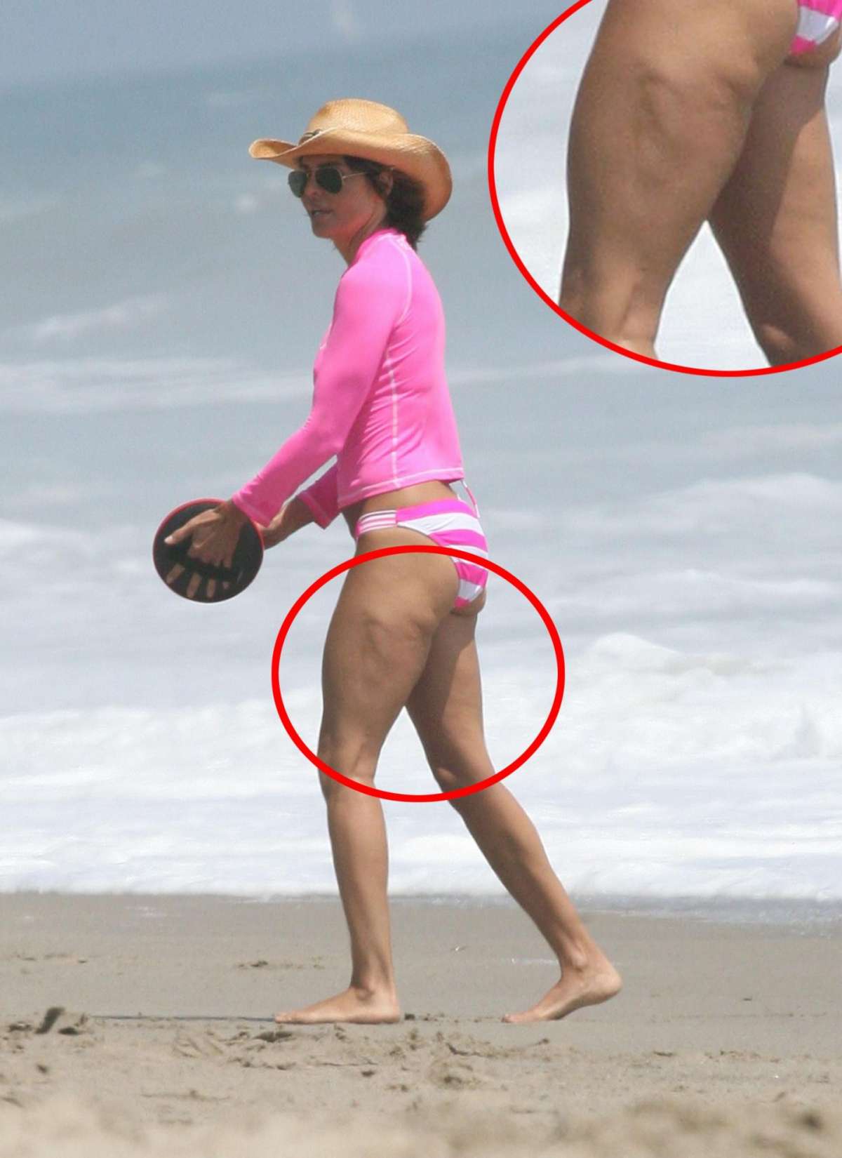 Foto cellulite vip e smagliature