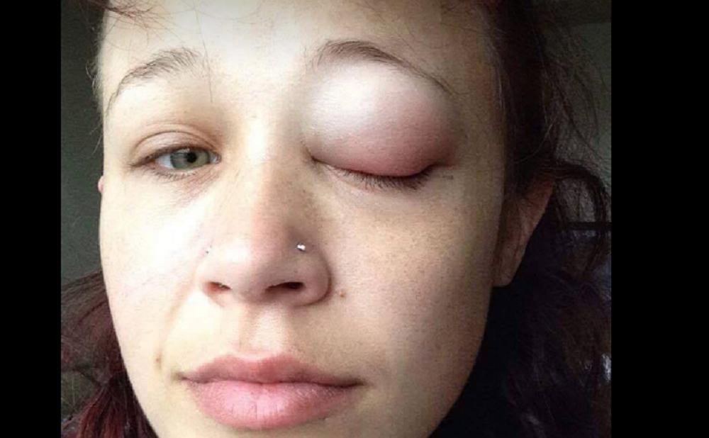 Modella rischia di diventare cieca per tatuaggio oculare