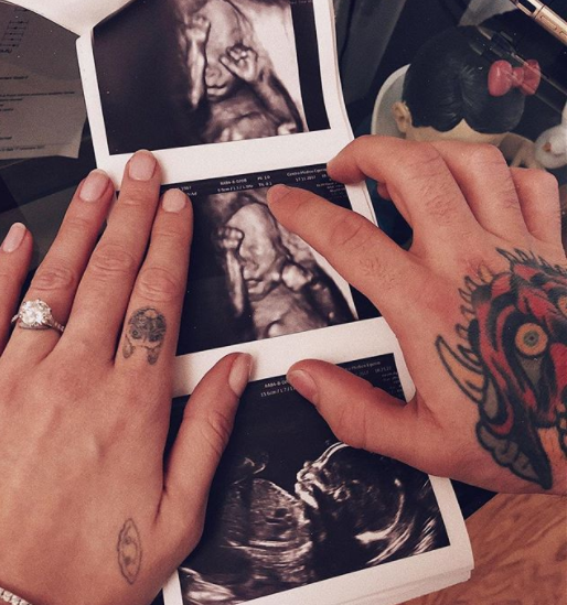 chiara ferragni e fedez nome bebé