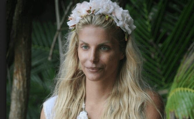 chirurgia estetica, chirurgia plastica