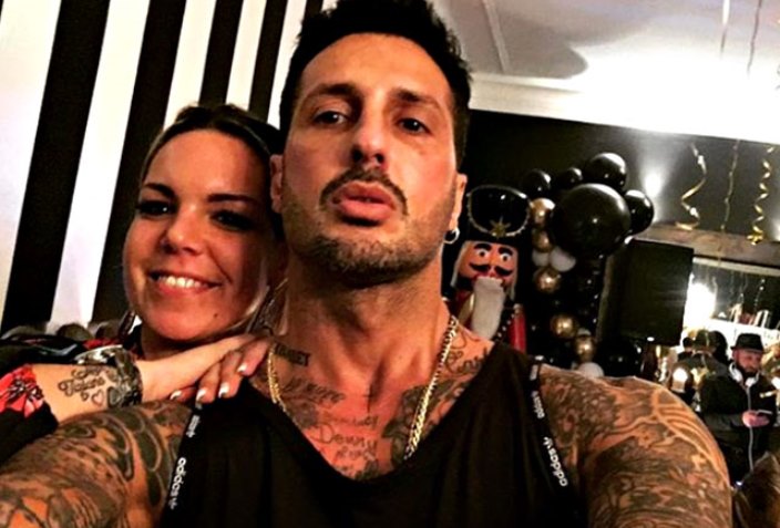 Fabrizio Corona botox