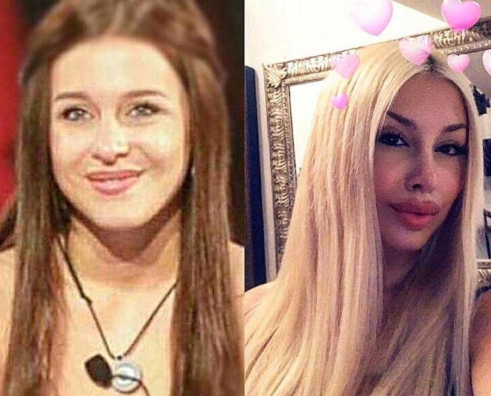 Asia Nuccetelli prima e dopo