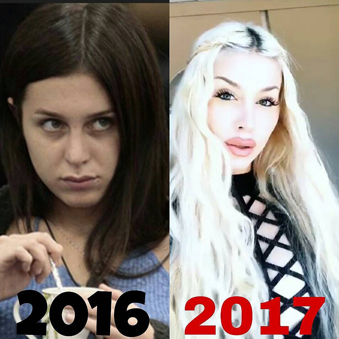 Asia Nuccetelli prima e dopo