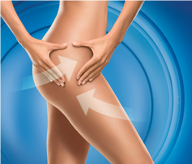 come eliminare la cellulite