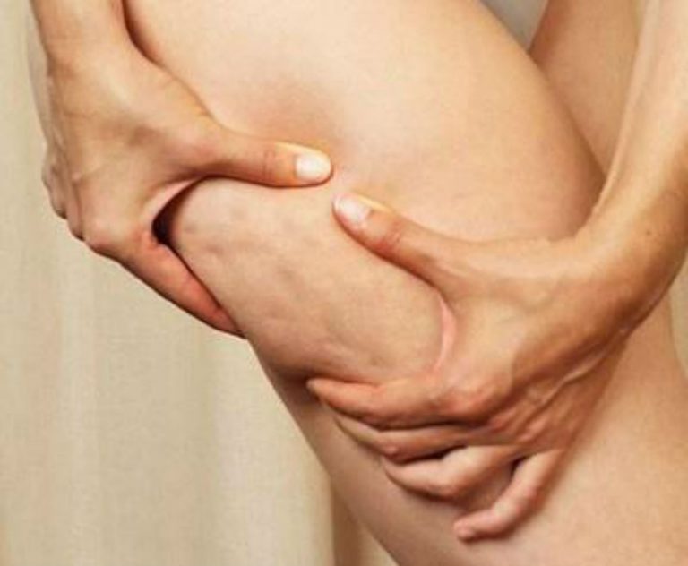 come dimagrire le cosce