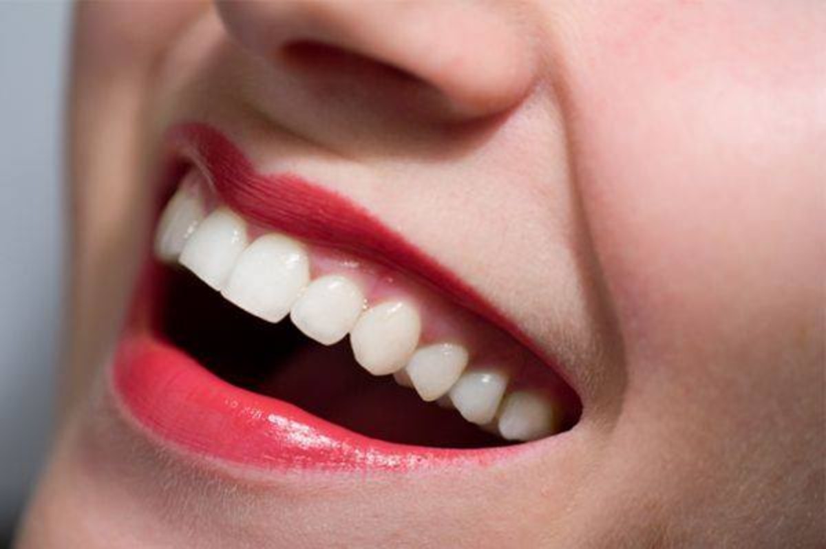 denti ingialliti