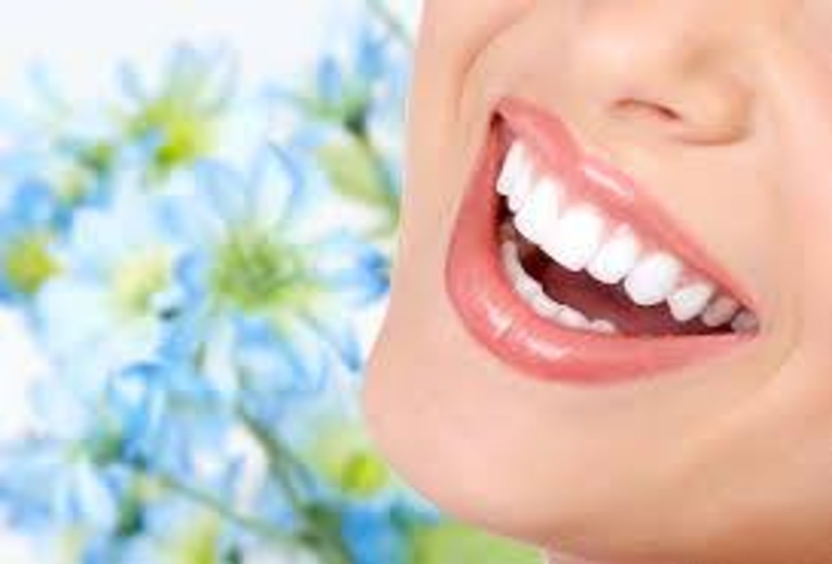 denti gialli