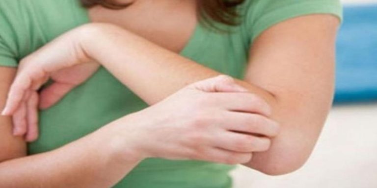 scabbia in gravidanza