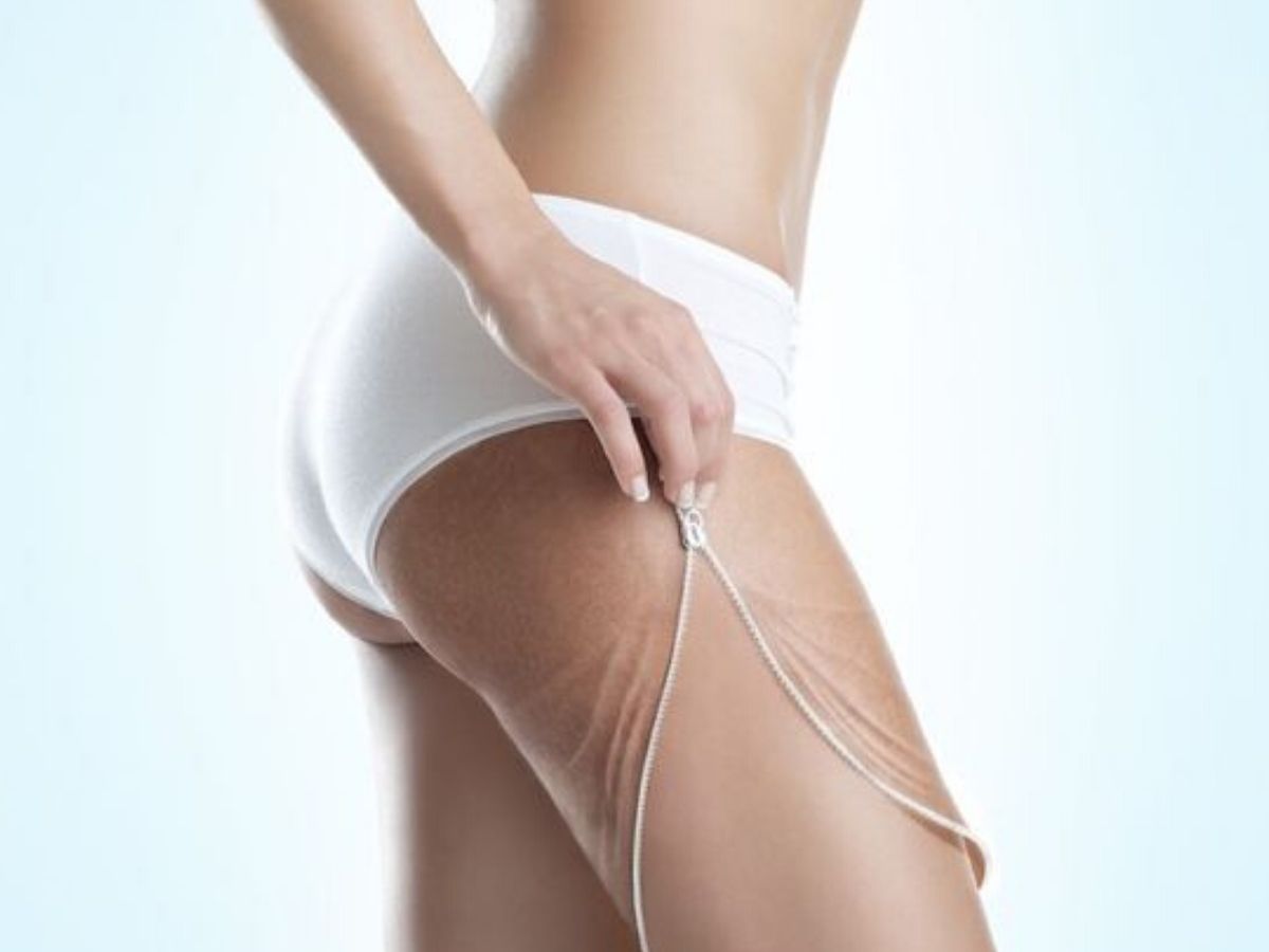 fanghi anticellulite fai da te