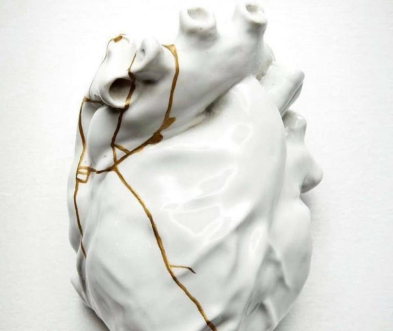 Filosofia Kintsugi cos'è?