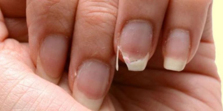 come fare crescere le unghie velocemente