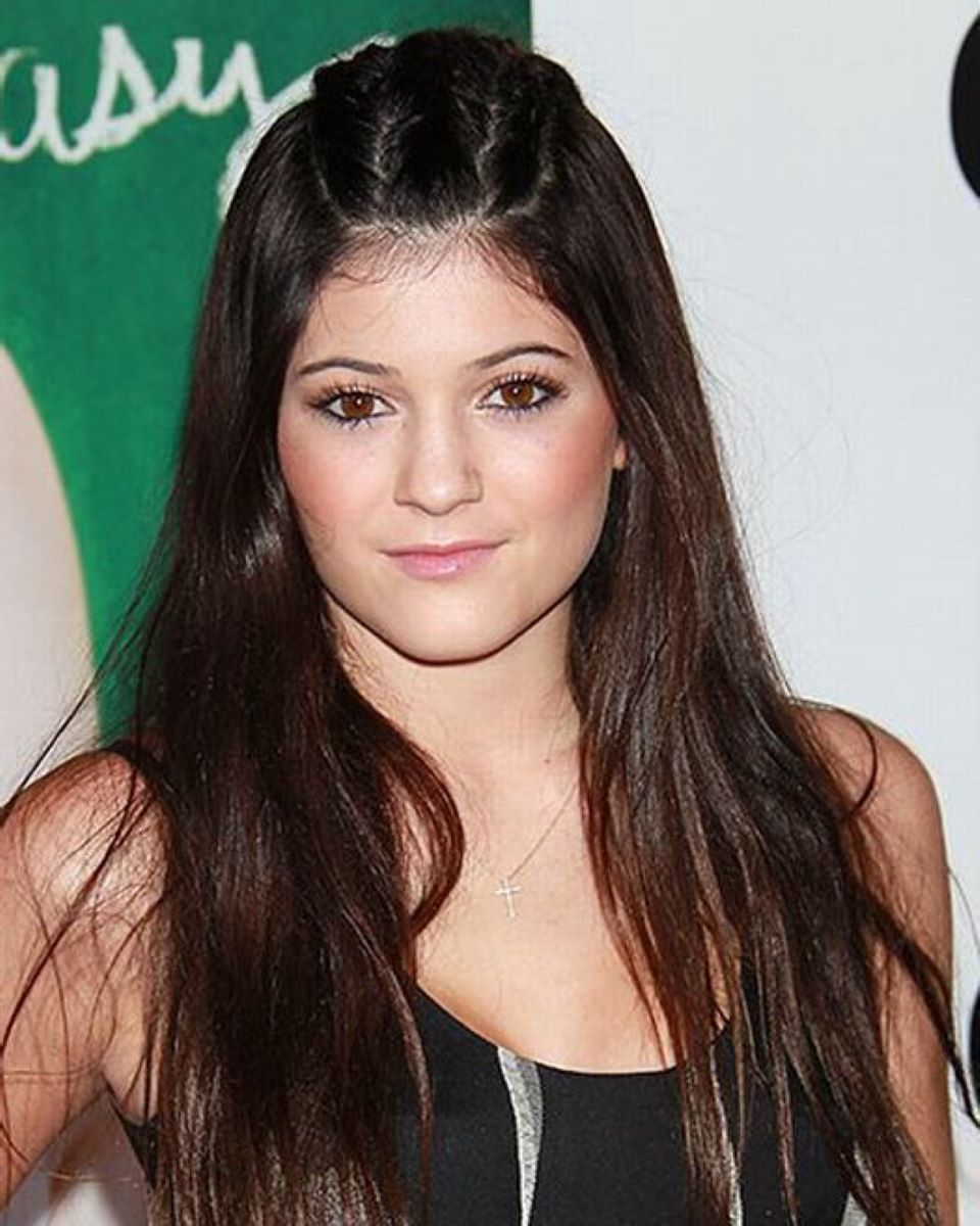 star prima e dopo come sono cambiate