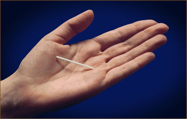 contraccettivi ormonali quali sono