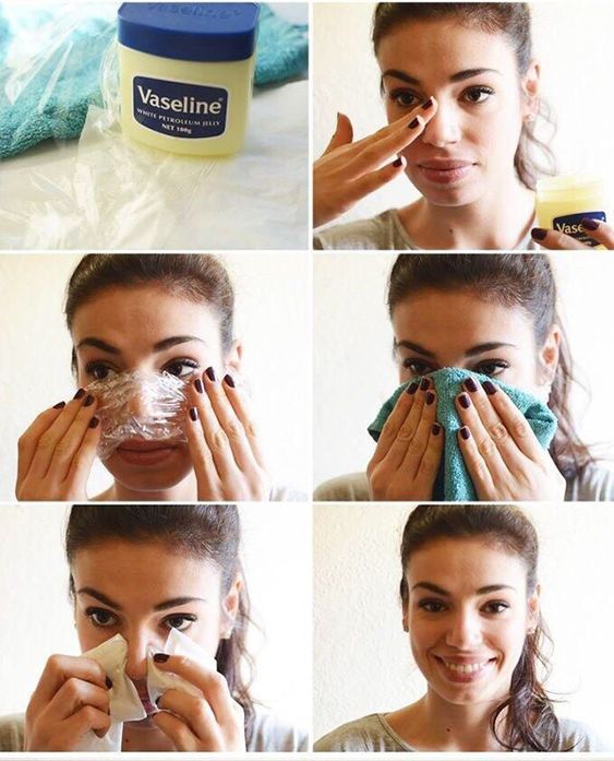 vaselina a cosa serve