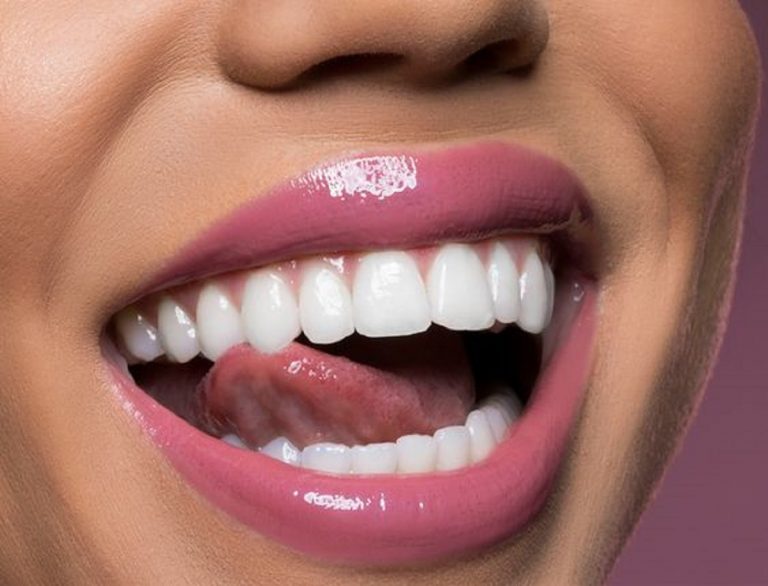 igiene orale perfetta consigli