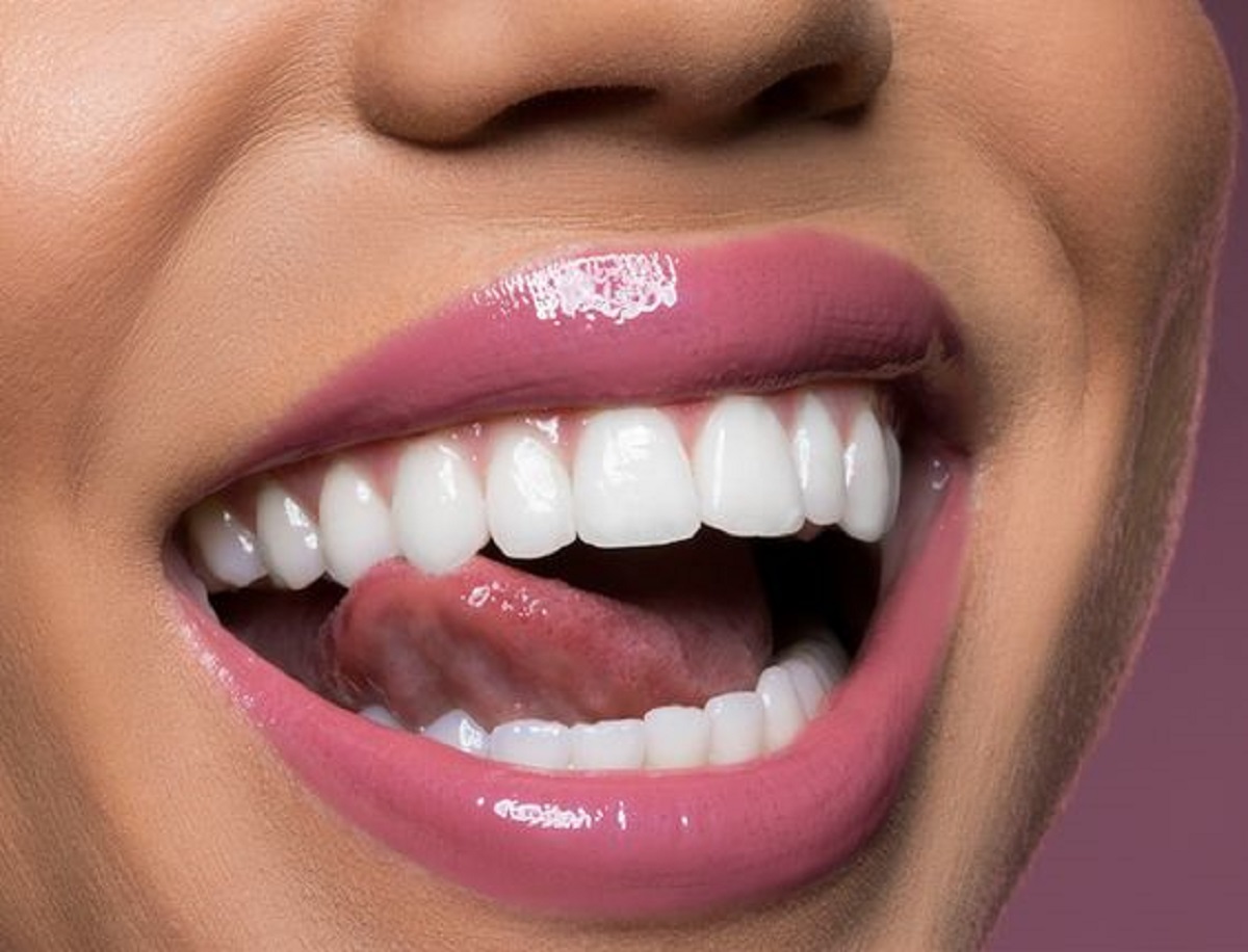 igiene orale perfetta consigli