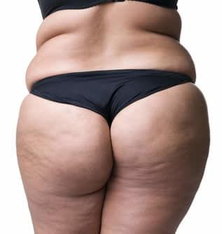 massaggio drenante ritenzione idrica