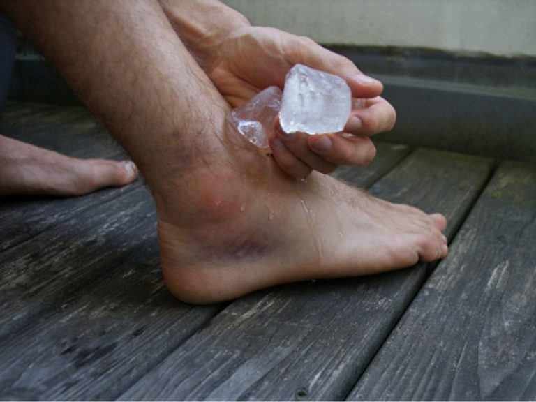 caviglie gonfie cause e rimedi