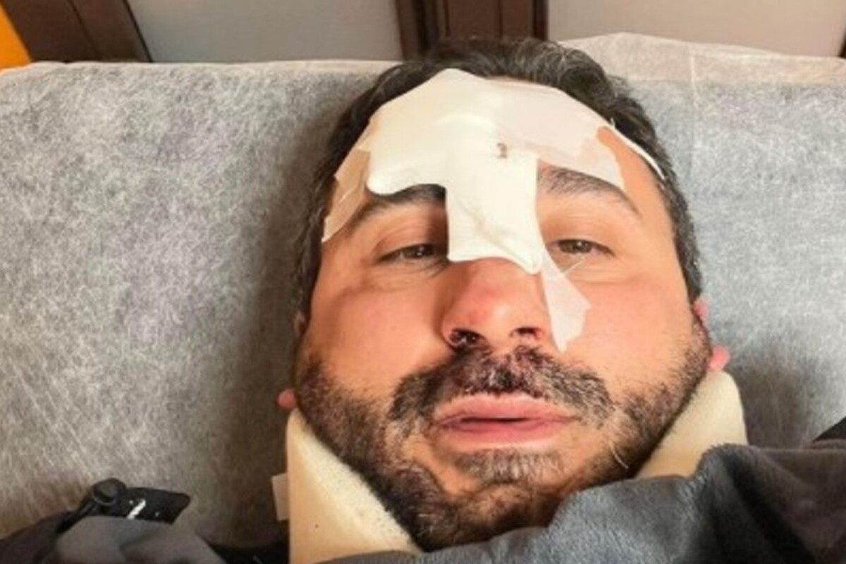 natale giunta incidente