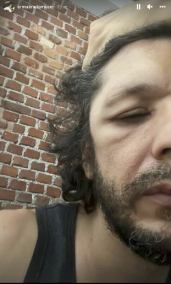 Ermal Meta