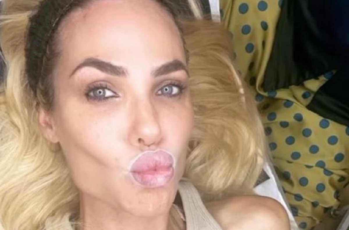 Ilary Blasi ritocco labbra