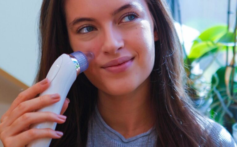 aspiratore punti neri