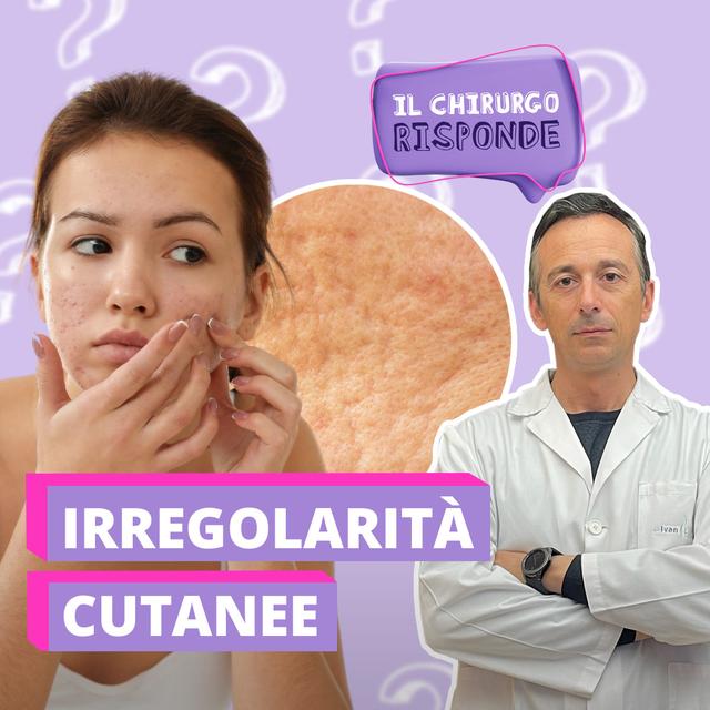 Irregolarità cutanee: come trattarle?